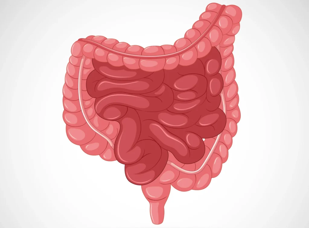 how to improve gut health